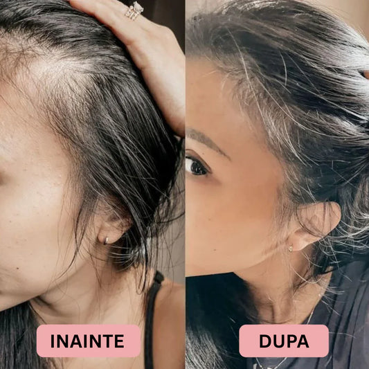 Perie terapeutică 4 în 1 cu masaj pentru stimularea creșterii părului